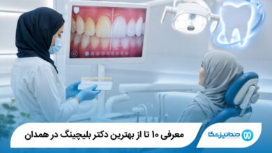 بهترین دکتر بلیچینگ در همدان