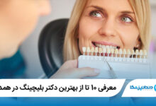 بهترین دکتر بلیچینگ در همدان