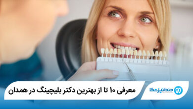 بهترین دکتر بلیچینگ در همدان