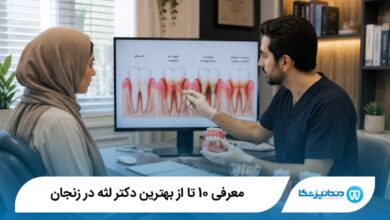 بهترین دکتر لثه در زنجان