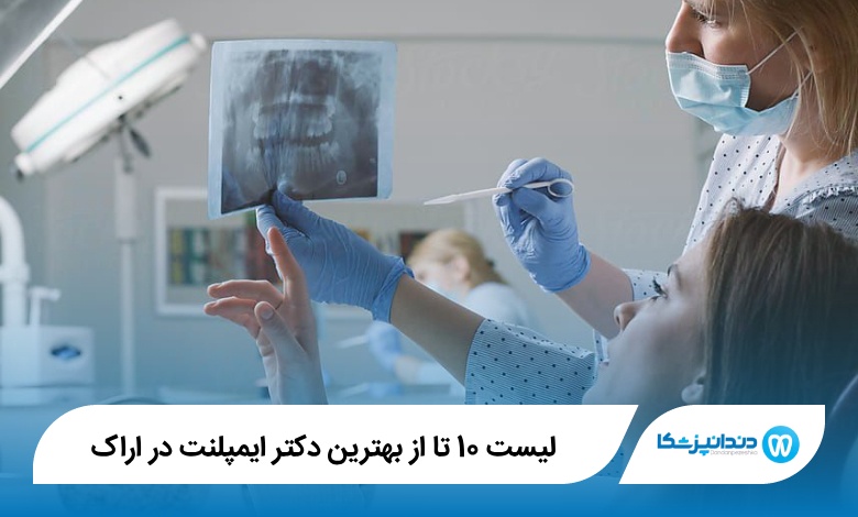 بهترین دکتر ایمپلنت در اراک