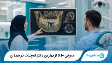 بهترین دکتر ایمپلنت‌ در همدان