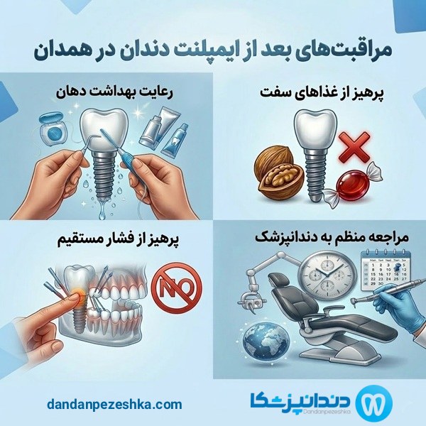 مراقبت های بعد از ایمپلنت دندان در همدان