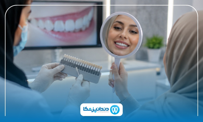 بهترین برندهای لمینت دندان در همدان