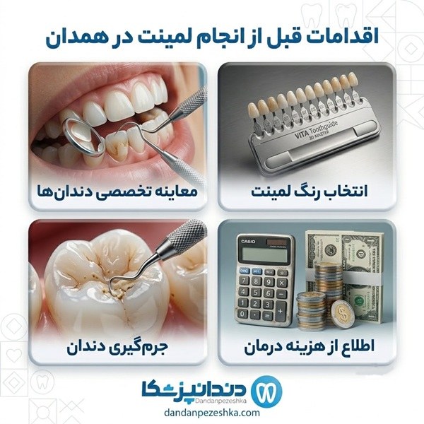 اقدامات قبل از انجام لمینت در همدان