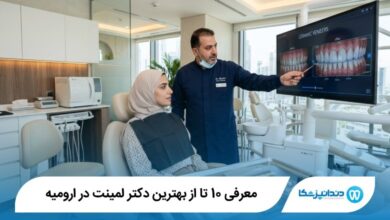 بهترین دکتر لمینت در ارومیه