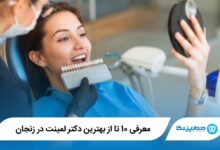 بهترین دکتر لمینت در زنجان