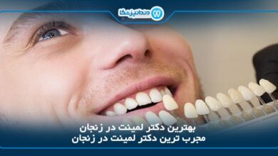 بهترین دکتر لمینت در زنجان