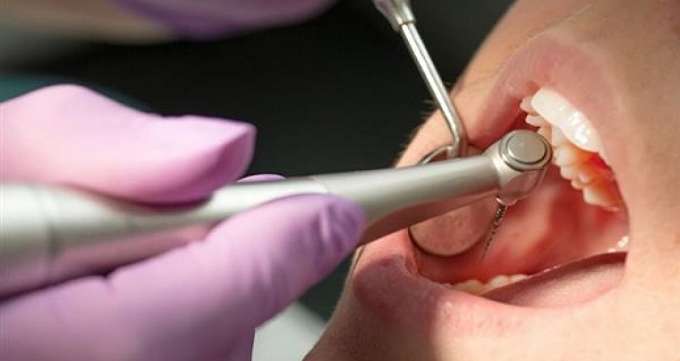 عواقب عدم درمان به موقع ریشه دندان