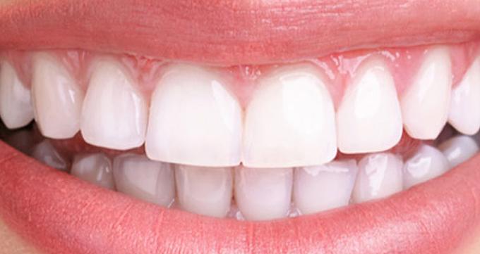 عوامل ایجاد اختلال در میدیلاین دندان