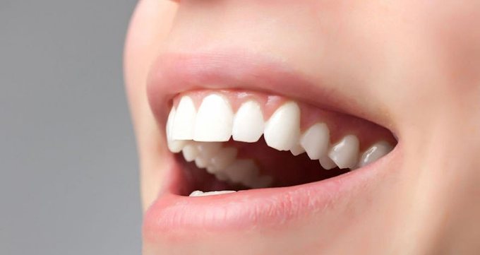 روش های درمانی برای تصحیح میدیلاین دندان