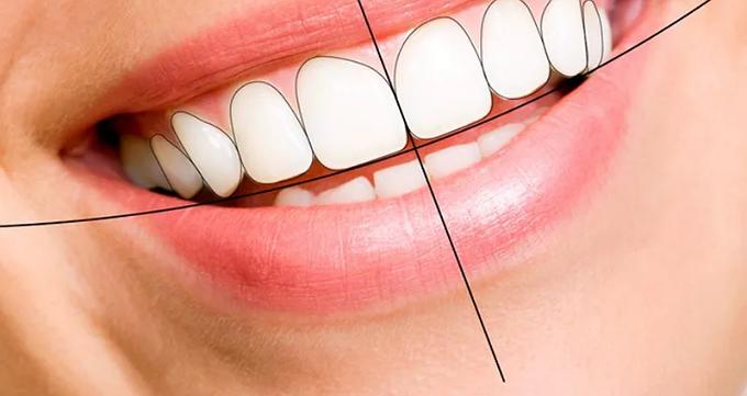میدیلاین دندان چیست؟