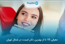 بهترین دکتر لمینت در شمال تهران