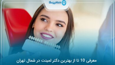 بهترین دکتر لمینت در شمال تهران