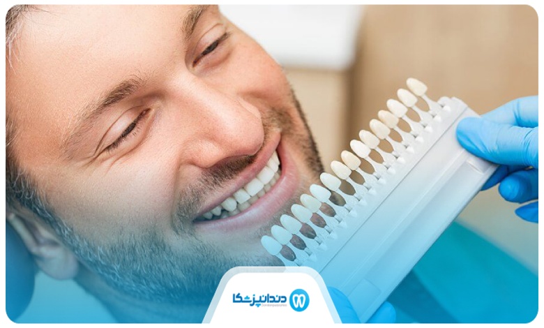 انجام کامپوزیت به چه کسانی توصیه می شود؟