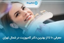 بهترین دکتر کامپوزیت در شمال تهران