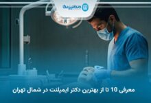 بهترین دکتر ایمپلنت در شمال تهران