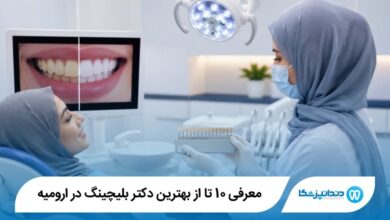 بهترین دکتر بلیچینگ در ارومیه