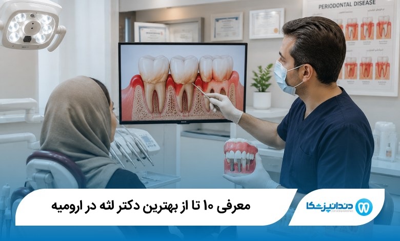 بهترین دکتر لثه در ارومیه