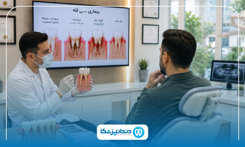 جراحی فلپ لثه چیست و چگونه انجام میشود؟