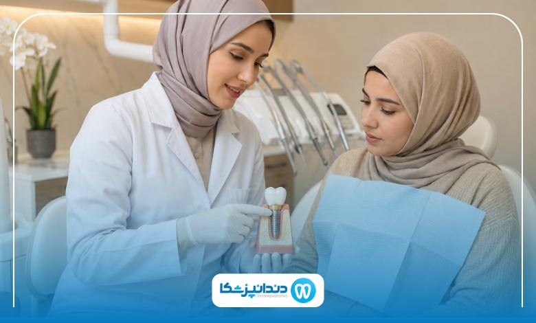 مقایسه ایمپلنت