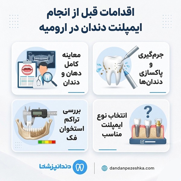 اقدامات قبل از انجام ایمپلنت دندان 