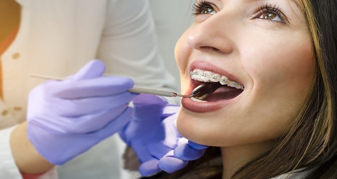 اجزای مختلف ارتودنسی دندان