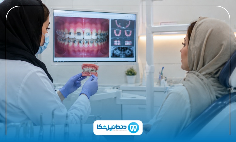 انواع براکت های ارتودنسی در اراک