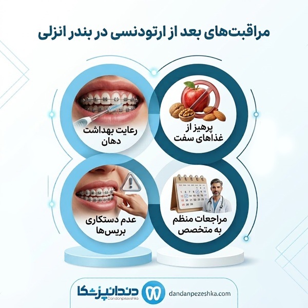 مراقبت های بعد از ارتودنسی در بندر انزلی