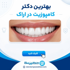 بهترین دکتر کامپوزیت در اراک