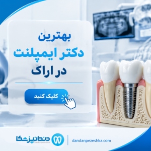 بهترین دکتر ایمپلنت در اراک