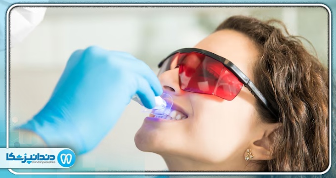 وظایف بهترین دکتر بلیچینگ در ارومیه