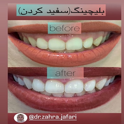 دکتر زهرا جعفری