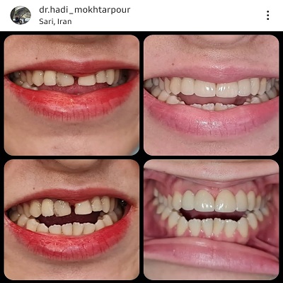 دکتر هادی مختارپور