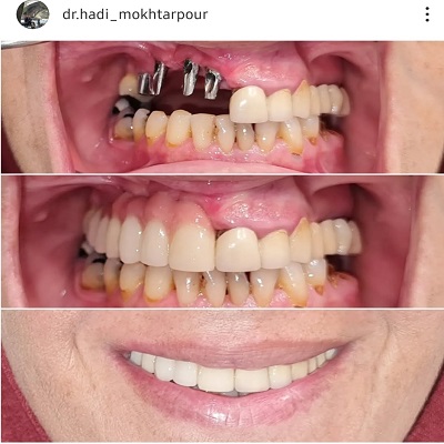 دکتر هادی مختارپور