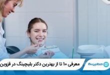 بهترین دکتر بلیچینگ در قزوین