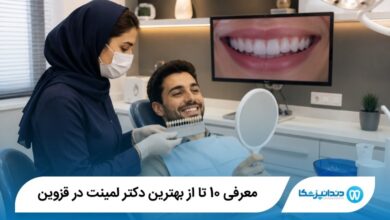 بهترین دکتر لمینت در قزوین