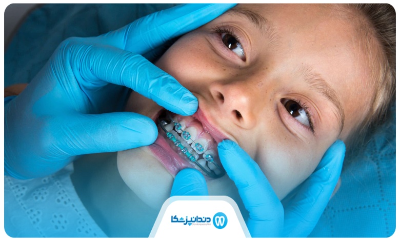 درمان با بهترین متخصص ارتودنسی نوجوانان در شمال تهران