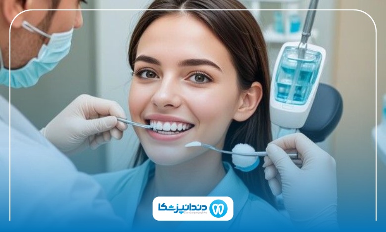 مقایسه لمینت و کامپوزیت دندان