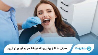 بهترین دندانپزشک جرم گیری در ایران