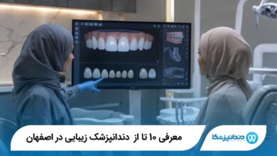 بهترین دندانپزشک زیبایی در اصفهان