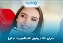 بهترین دکتر کامپوزیت در کرج