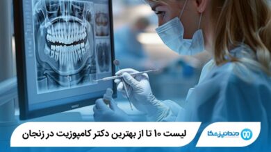 10 تا از بهترین دکتر کامپوزیت در زنجان