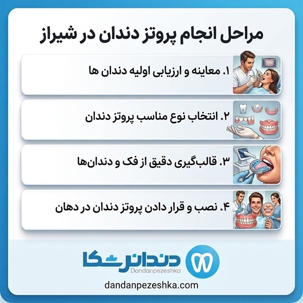 مراحل انجام پروتز دندان در شیراز