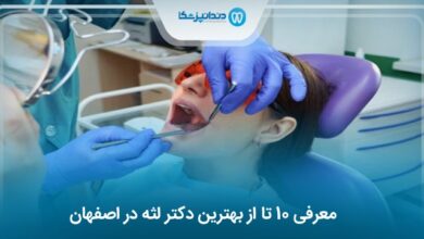 بهترین دکتر لثه در اصفهان
