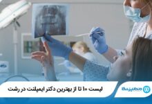 بهترین دکتر ایمپلنت در رشت