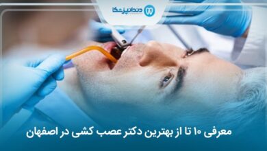 بهترین دکتر عصب کشی در اصفهان