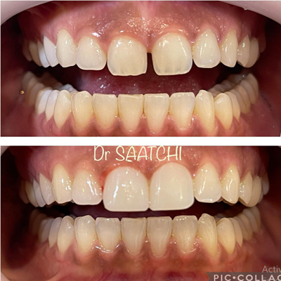 دکتر سامان ساعتچی طهرانی