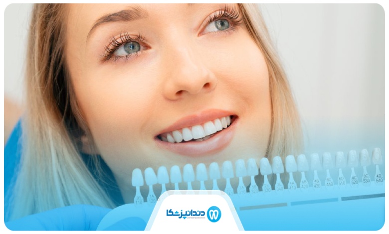 بلیچینگ دندان چیست؟