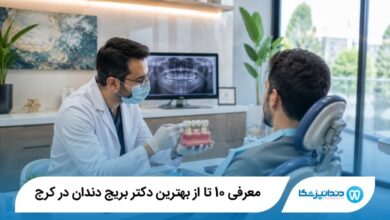 بهترین دکتر بریج دندان در کرج